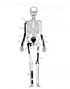 skeletos3